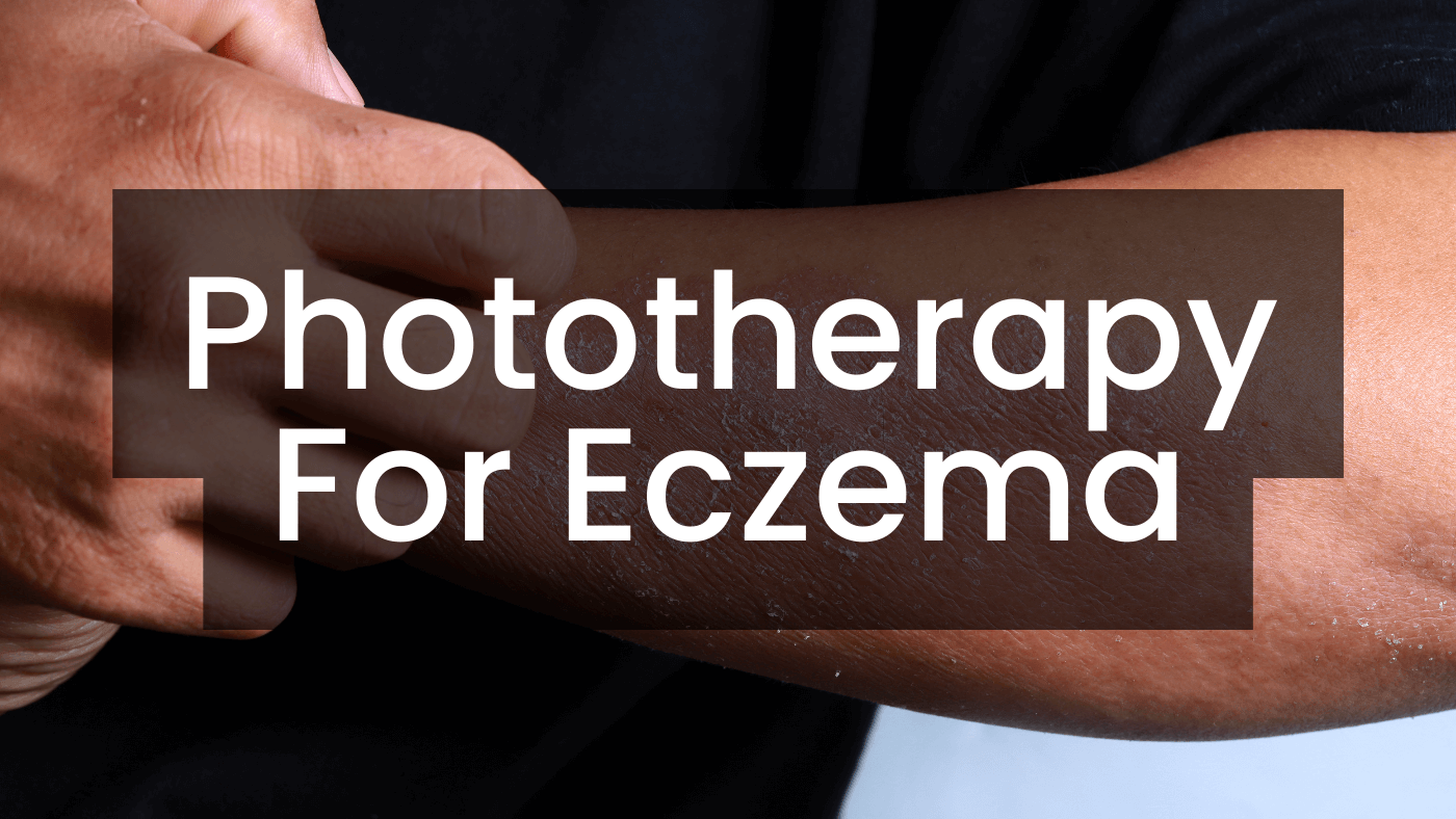 Phototherapy For Eczema Care Lamps