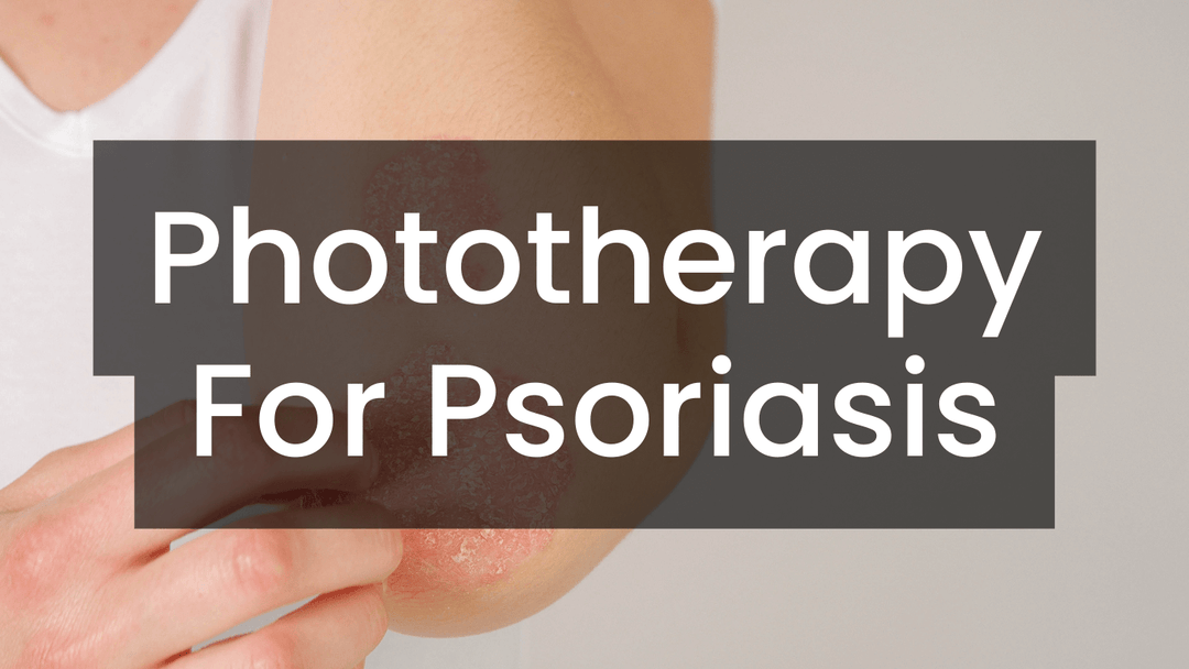 Phototherapy for Psoriasis Care Lamps