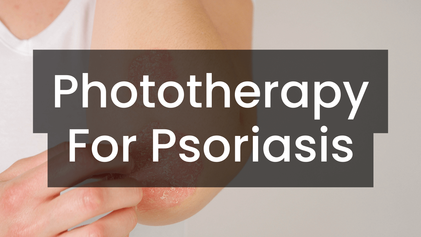 Phototherapy For Psoriasis Care Lamps