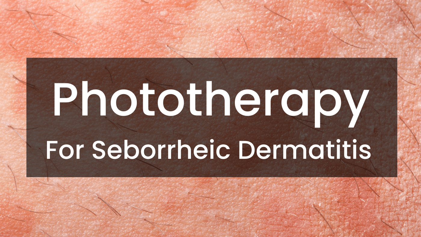 Phototherapy for seborrheic dermatitis