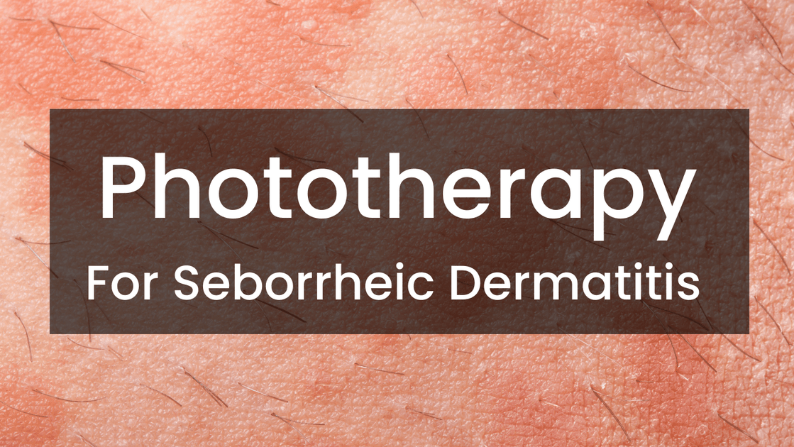 Phototherapy for seborrheic dermatitis – Care Lamps