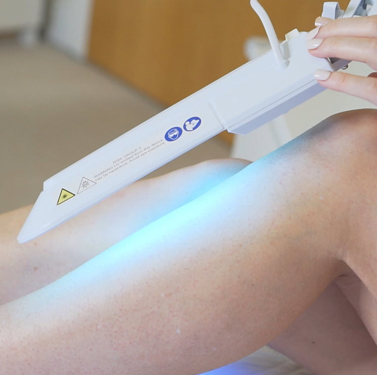 Derma UVB: Psoriasis & Eczema Narrowband Phototherapy Lamp (311nm ...